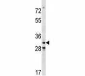 Cdk4 antibody western blot analysis in mouse NIH3T3 lysate.