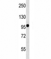 Integrin beta 7 antibody western blot analysis in WiDr lysate.