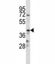 CD86 antibody western blot analysis in NCI-H292 lysate