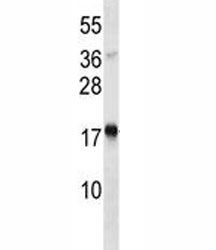 TSLP antibody western blot analysis in Jurkat lysate.