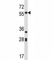 SOX11 antibody western blot analysis in K562 lysate