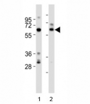 Western blot testing of SOX11 antibody at 1:2000 dilution. Lane 1: rat brain lysate; 2: human brain lysate; Predicted/observed molecular weight ~47kDa/60kDa (PMID: 19880779).