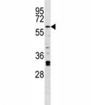 Irak2 antibody western blot analysis in A375 lysate.