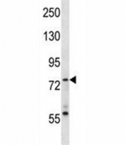 Syk antibody western blot analysis in MDA-MB453 lysate. Predicted molecular weight: 72 kDa.