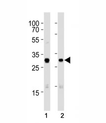 Western blot analysis of lysate from (1) A431 and (2) SK-BR-3 cell line using Cdk1 antibody at 1:1000. Predicted molecular weight: ~33 kDa.~