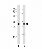 Western blot analysis of lysate from (1) A431 and (2) SK-BR-3 cell line using CDK1 antibody at 1:1000. Predicted molecular weight: ~33 kDa.