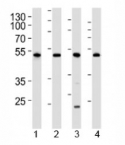 Western blot analysis of lysate from 1) human 293, 2) mouse NIH3T3, 3) rat C6 cell line and 4) mouse kidney tissue lysate using Cdk9 antibody at 1:1000. Predicted molecular weight ~43 kDa.