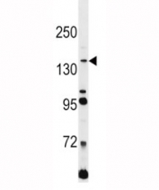 L1CAM antibody western blot analysis in Jurkat lysate. Expected molecular weight of unglycosylated protein is 140-150 kDa.