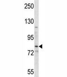 SMO antibody western blot analysis in HepG2 lysate.