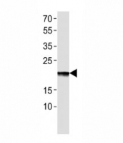 Western blot analysis of lysate from EPO recombinant protein using Erythropoietin antibody at 1:1000.