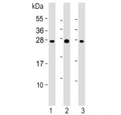 Western blot testing of 1) human kidney, 2) human liver and 3) mouse liver lysate with Erythropoietin antibody at 1:2000. Expected molecular weight: 18-34 kDa depending on glycosylation level.