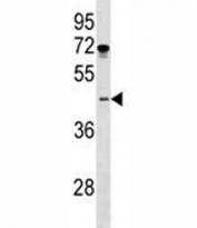 ISL1 antibody western blot analysis in MDA-MB231 lysate. Predicted molecular weight ~39 kDa.