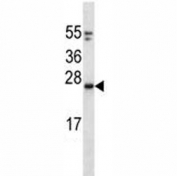 KRAS antibody western blot analysis in mouse NIH3T3 lysate. Predicted molecular weight: 20-25 kDa.