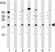 Western blot testing of 1) human 293T/17, 2) mouse C2C12, 3) human HeLa, 4) human HT-29, 5) human K562, 6) rat PC-12 and 7) human Ramos cell lysate with KRAS antibody at 1:2000. Expected molecular weight: 20-25 kDa.