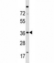 ISL2 antibody western blot analysis in A2058 lysate