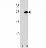Western blot analysis of ATF3 antibody and 293 cell lysate (2 ug/lane) either nontransfected (Lane 1) or transiently transfected (2) with the ATF3 gene.