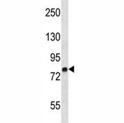 MMP9 antibody western blot analysis in NCI-H292 lysate. Predicted molecular weight: 82-92 kDa