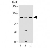 Western blot testing of mouse 1) small intestine, 2) liver and 3) spleen lysate with Nlrp6 antibody. Predicted molecular weight ~97 kDa.