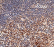 IHC testing of FFPE mouse spleen tissue with Nlrp6 antibody. HIER: steam section in pH9 EDTA buffer for 20 min and allow to cool prior to staining.