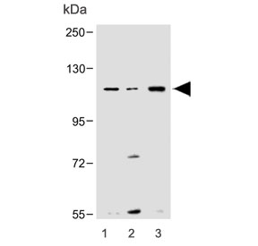 Western blot testing of mouse 1) small intestine, 2) liver and 3) spleen lysate with Nlrp6 antibody. Predicted molecular weight ~97 kDa.