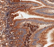 IHC testing of FFPE mouse small intestine tissue with Nlrp6 antibody. HIER: steam section in pH9 EDTA buffer for 20 min and allow to cool prior to staining.