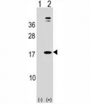 Western blot analysis of LEP antibody and 293 cell lysate (2 ug/lane) either nontransfected (Lane 1) or transiently transfected (2) with the human gene. Predicted molecular weight ~16 kDa.