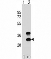 Western blot analysis of CD79b antibody and 293 cell lysate (2 ug/lane) either nontransfected (Lane 1) or transiently transfected (2) with the CD79B gene.