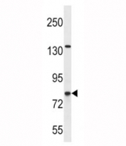 CPT1B antibody western blot analysis in SK-BR-3 lysate. Predicted molecular weight ~88kDa.