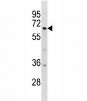 DYRK1B antibody western blot analysis in 293 lysate. Predicted molecular weight: 69/75 kDa (isoforms 1/3).