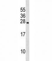 Prolactin antibody western blot analysis in human 293 lysate. Predicted molecular weight ~26 kDa.