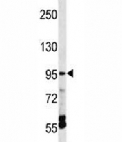 TRPV5 antibody western blot analysis in HepG2 lysate.