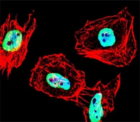 Fluorescent confocal image of HeLa cell stained with HDAC antibody at 1:25. HDAC1 immunor