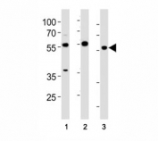 HDAC antibody western blot analysis in (1) HeLa cell line and (2) mouse testis, (3) rat testis tissue lysate. Predicted molecular weight 55~60 kDa