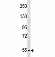 PCSK4 antibody western blot analysis in SK-BR-3 lysate.