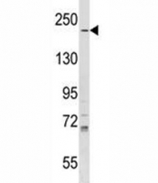 IQGAP1 antibody western blot analysis in T47D lysate. Predicted molecular weight ~189 kDa.