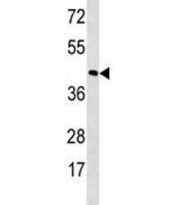 RHO antibody western blot analysis in MDA-MB453 lysate. Predicted molecular weight: 40 kDa.