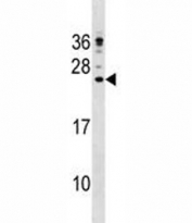 CAMP antibody western blot analysis in NCI-H292 lysate