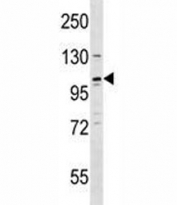 REST antibody western blot analysis in Jurkat lysate.