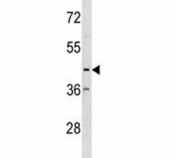 CX3CR1 antibody western blot analysis in K562 lysate. Predicted molecular weight ~40kDa.
