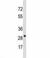 VDAC3 antibody western blot analysis in NCI-H460 lysate.