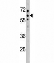 SOCS7 antibody western blot analysis in HeLa lysate.