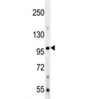 BMP1 antibody western blot analysis in mouse liver tissue lysate. Predicted molecular weight: ~111 kDa.