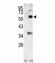 Western blot analysis of BMP3 antibody and 293 cell lysate (2 ug/lane) either nontransfected (Lane 1) or transiently transfected with the BMP3 gene (2).