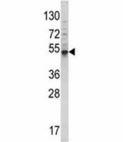 Western blot analysis of BMP3 antibody and 293 lysate. Predicted molecular weight ~55 kDa.