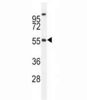 BMP4 antibody western blot analysis in MDA-MB435 lysate. Predicted molecular weight: 54 kDa (precursor), 44 kDa (cleaved dimer), 23 kDa (cleaved monomer).