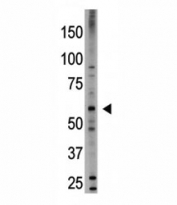 Western blot testing of BMP6 antibody and HL-60 cell lysate. Expected molecular weight: ~57kDa (precursor), ~46kDa (cleaved precursor), 18-23kDa (mature).