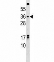 NKX3.1 antibody western blot analysis in U251 lysate. Predicted molecular weight ~28 kDa, observed at 28-38 kDa.