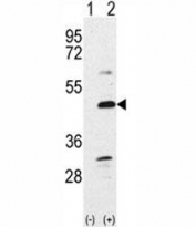 Western blot analysis of BMP7 antibody and 293 cell lysate either nontransfected (Lane 1) or transiently transfected with the BMP7 gene (2). Predicted molecular weight: 49 kDa protein cleaved into ~33 and ~15 kDa segments.