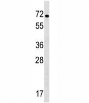 NOX1 antibody western blot analysis in WiDr lysate.