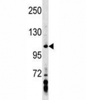 AXIN1 antibody western blot analysis in MDA-MB453 lysate. Predicted molecular weight: 95-110 kDa.